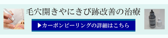 カーボンピーリングのトライアルプラン