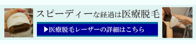 レーザー脱毛のトライアルプラン