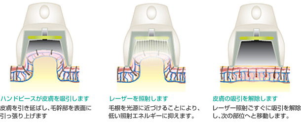 ライトシェア・デュエットの新システム