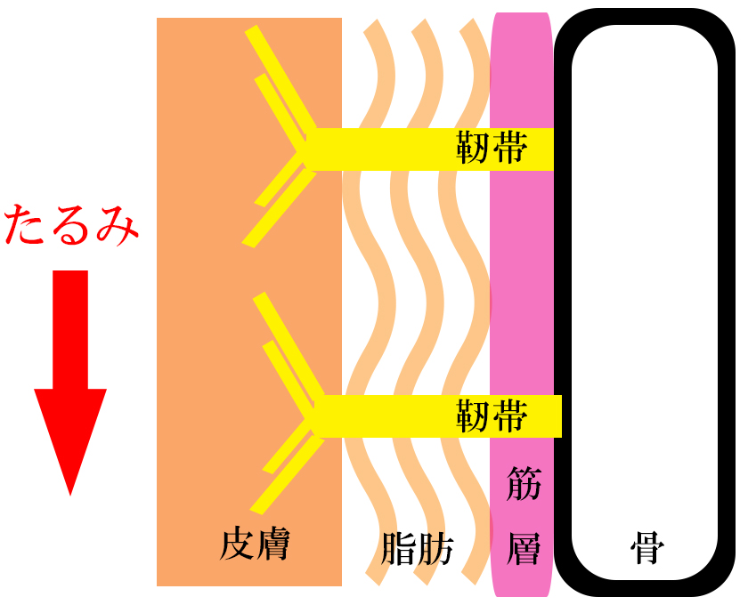 たるみ、ほうれい線の原因、骨