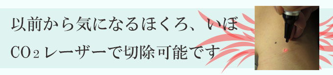 ほくろ、いぼ治療、いぼとり、皮膚科、レーザー、横浜